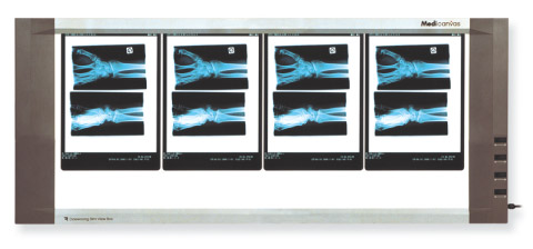Négatoscopes Négatoscope Extra Plat Parapharm