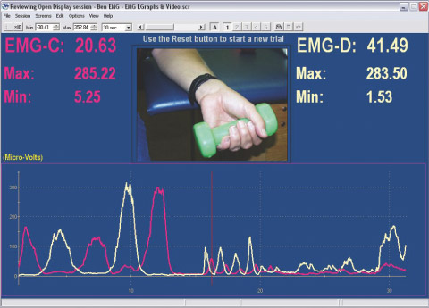 appareil de biofeedback