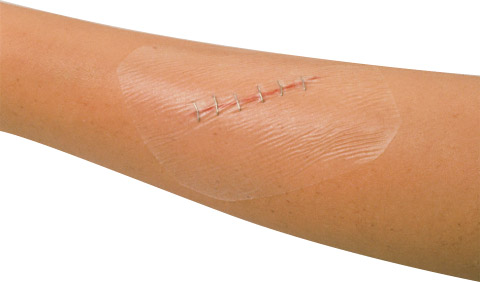 pansement adhesif sterile transparent