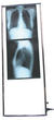 Négatoscopes Négatoscope vertical Parapharm