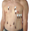 Electrocardiographe Electrodes Parapharm