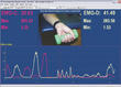 appareil de biofeedback
