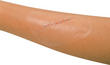 pansement adhesif sterile transparent